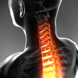 Indianapolis spinal cord injury lawyer 